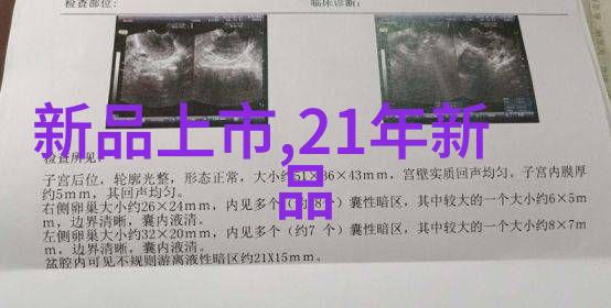 选择智选天玑芯片与骁龙双雄争霸